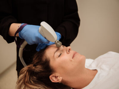 RF Pixel - Skin Resurfacing