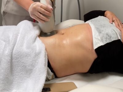 Body Contouring